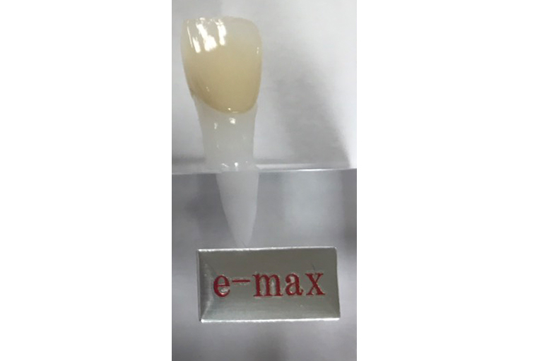 e-max
