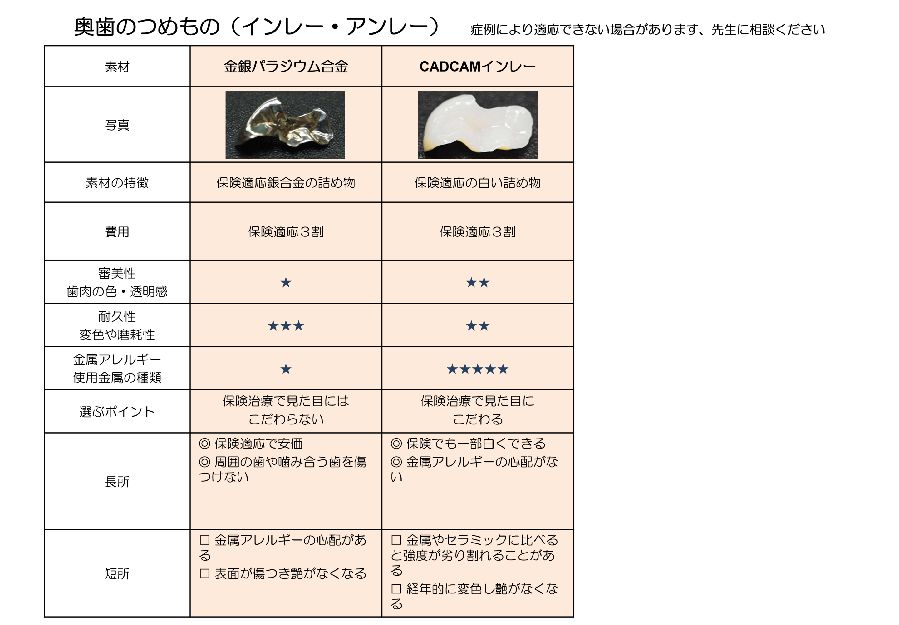 奥歯のインレー・アンレー